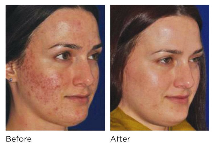 rejmedispa's tweet photo. Experience a new level of skin therapy with the Electronic Dermapen, providing unrivalled treatment that will:

• Reduce fine lines and wrinkles
• Fade scars and stretch marks
• Help heal sun damage
• Improve the appearance of cellulite https://t.co/eIJ4CbHFzu