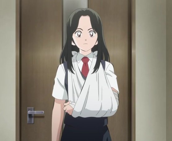 تويتر 平田 一郎 على تويتر アニメ版 Mix 第18話 左腕ギプス 三角巾吊りの少女の続き コマを繋ぎたくなる腕吊り姿 T Co Suqgxymp5q