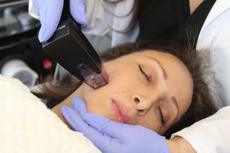 InmodeUK's tweet image. Morpheus8 is a device that combines microneedling &amp;amp; radio frequency to: ⁣
▫️Lift ⁣
▫️Increase collagen production ⁣
▫️Reduce wrinkles ⁣
▫️Improve the appearance of scars ⁣
.⁣
.⁣
#inmode #morpheus8 #microneedling#skincare #glow #wrinkles #bodytite #facetite#optimas