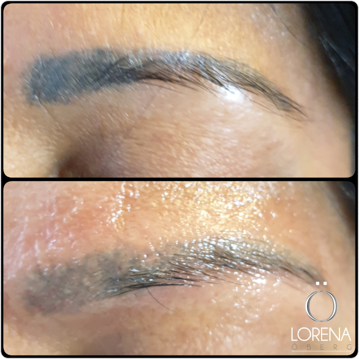 Nice fading straight after laser treatment.  Training available.  #brows #eyebrowtattoo #eyebrows #pmu #permanentmakeup #semipermanentmakeup #microblading #pmuremoval #permanentmakeupremoval #tattooremoval #tattoo