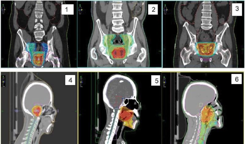 iRT Systems tweet media