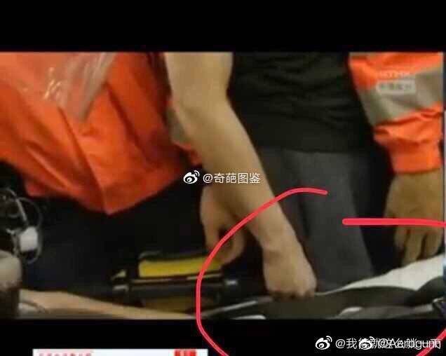 hunhanseven's tweet photo. #香港暴乱 
不是说和平示威的吗？ 打完人还掐输氧管？？？ https://t.co/4usiVT9m5B
