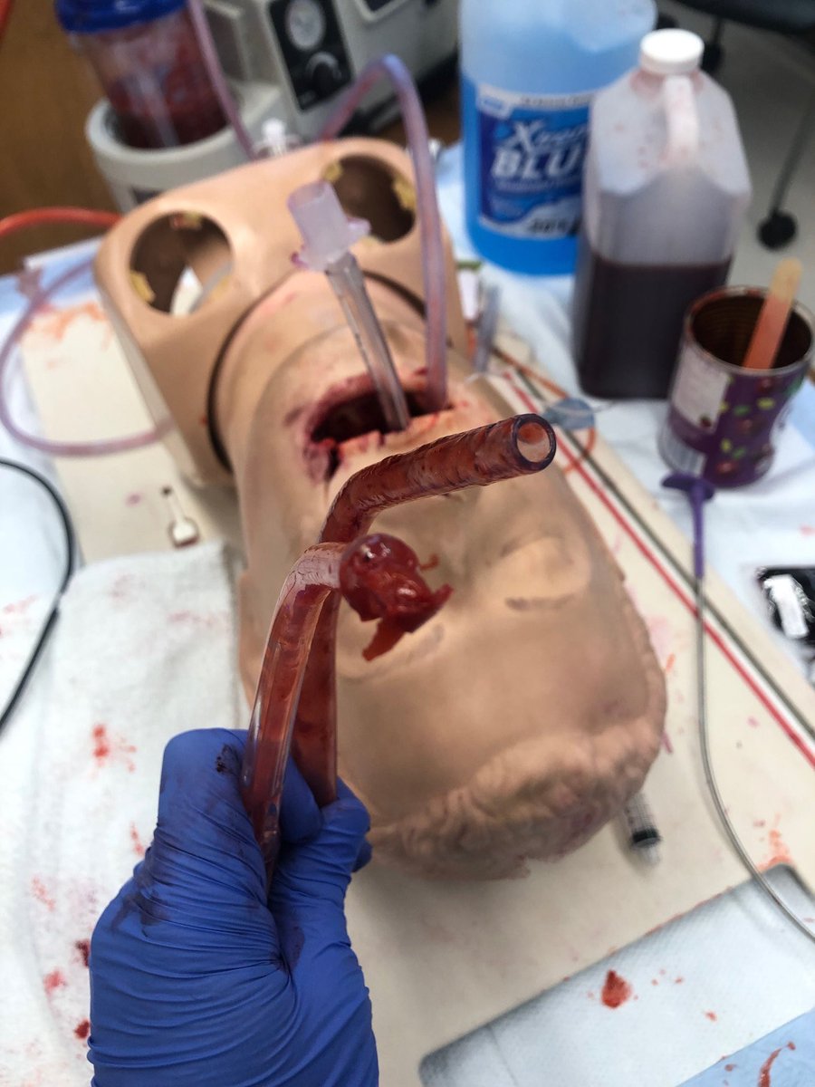 jducanto's tweet photo. @hotSahs @SSCORsuction Thanks Rup!! Our further #SALADSim has continued to show that the obstacles faced by EM/EMS/CritCare are amenable to updated equipment and techniques. Many thanks to @vamedic for the photo and many thanks to Sim masters @mededgene @airwayGladiator @LiWeiLin2 @DrJeffJarvis +More https://t.co/YqWLoYsHPE