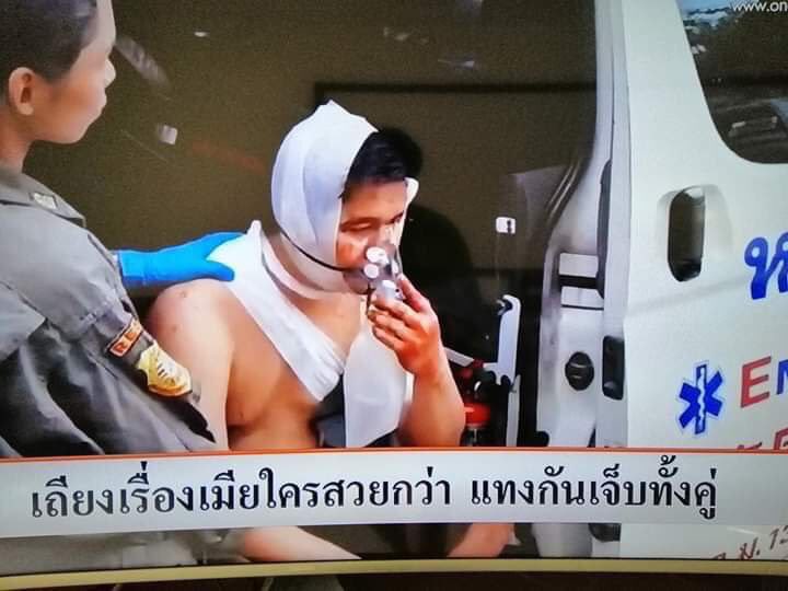 ภูผา tweet media