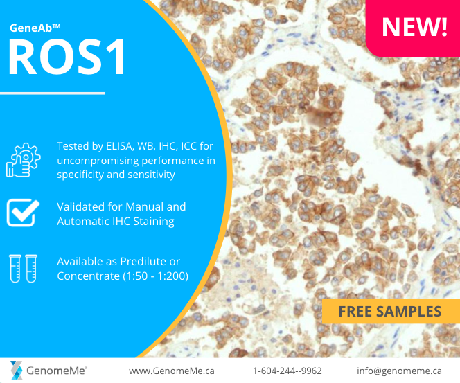 genome_me's tweet photo. NEW ANTIBODY!
Our new Ros1 Antibody is now launched!
Request your free sample: info@genomeme.ca or visit https://t.co/TqaClu6ktO

#pathology #ros1 #cancer https://t.co/hQg71gH7zG