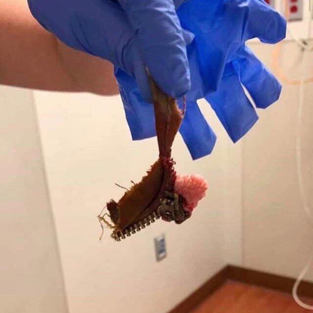 StetheH's tweet photo. Great idea I thought. Will be less sweaty on the betty i thought. Easy access i thought. Full of great ideas. THINK BEFORE GOING COMMANDO. #ZIPPERFAIL #TESTICLES #CROWNJEWELS #PAINFAIL #ACCIDENT #EMERGENCY #commando https://t.co/ONoDxIjyIH