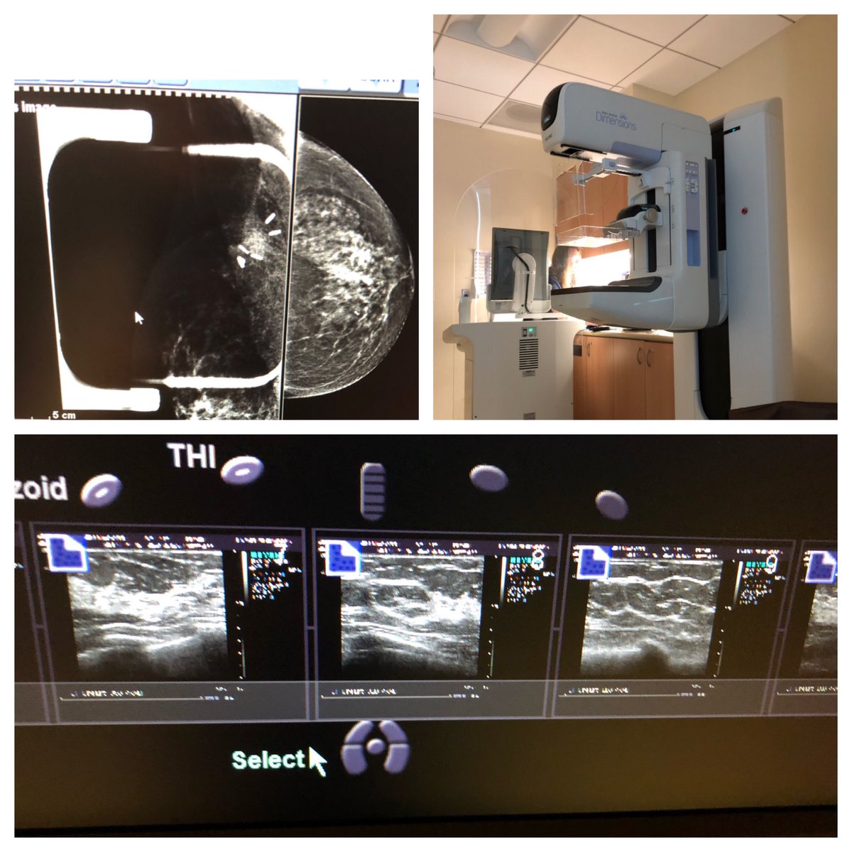 jaz1976's tweet photo. Never underestimate the power to take control of your health. Mammogram AND Sonogram all done. โ๏ธSharing in hopes to inspire those of you hesitant to not be. #Thriver #3YearsCancerFree ๐ https://t.co/ngPUmK8Msd