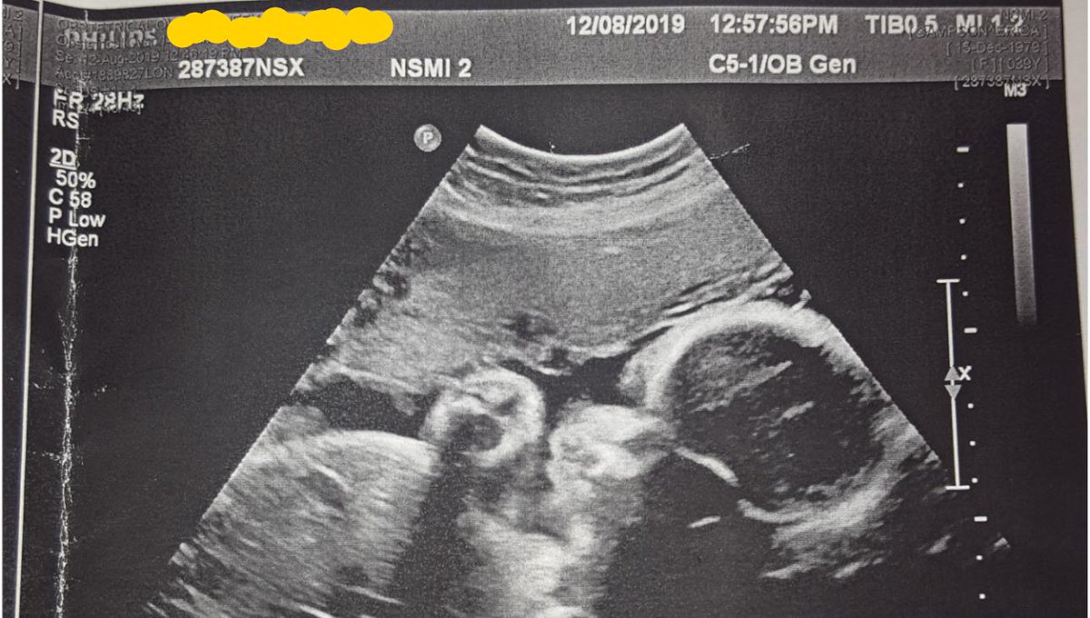 Skippy6Gaming's tweet photo. 9 weeks left 👶🤰🤱🍼🚼 before the baby comes!! https://t.co/T8q7Gl3K7u
