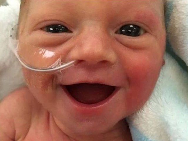 LifeNewsHQ's tweet image. Miracle Premature Baby Born Six Weeks Early Has a Million Dollar Smile buff.ly/2H5iNGy