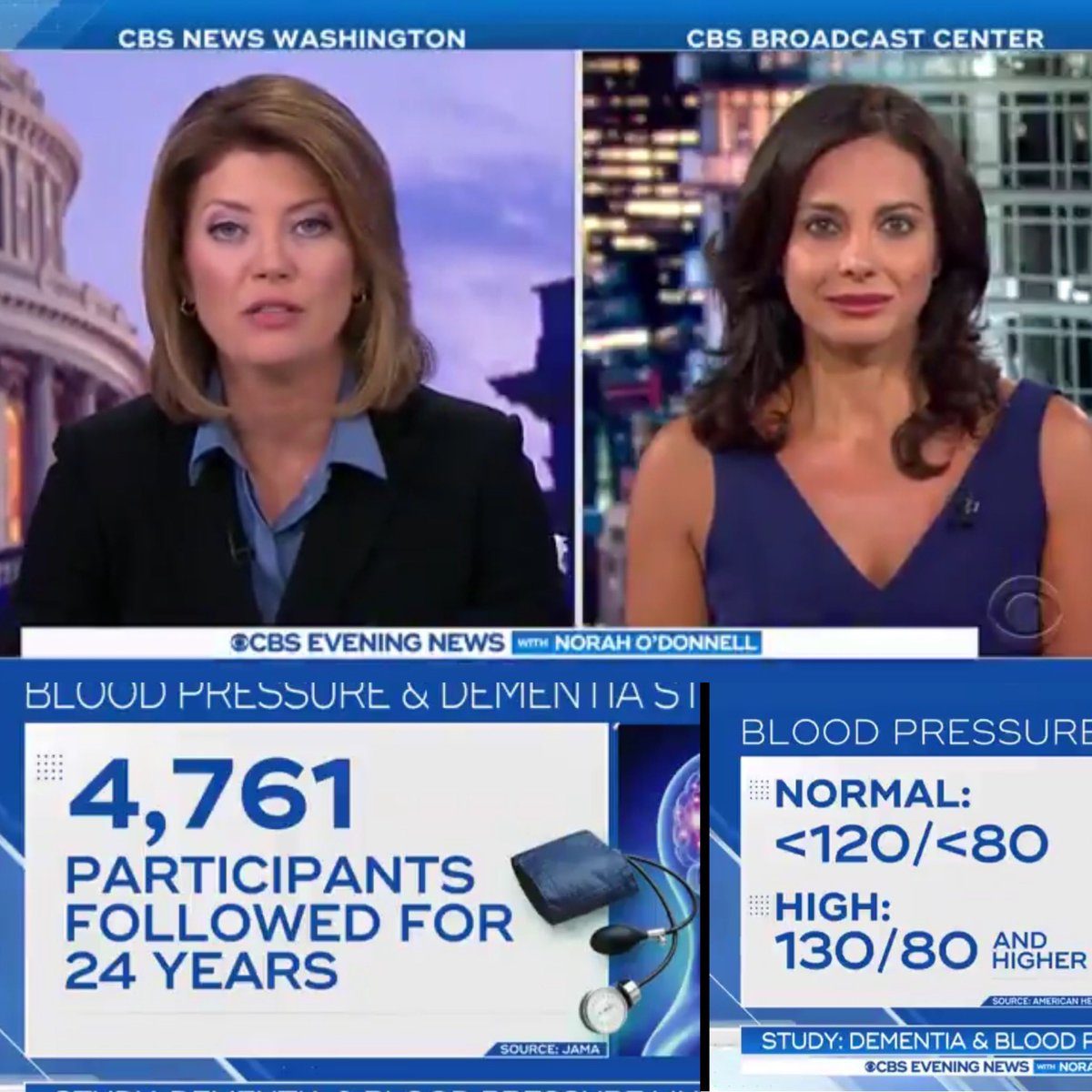 drtaranarula's tweet photo. Hypertension and dementia risk on tonight’s CBS Evening News @CBSEveningNews @CBSNews #hypertension #dementia @JAMA_current #ARIC #Sprintmind https://t.co/g8tDzxvOTo