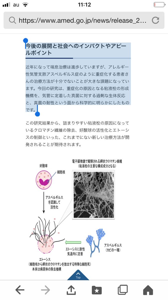 mansaqu's tweet photo. #アレルギー性気管支肺アスペルギルス症
#AMED
秋田大学大学院
植木重治先生ら
#好酸球 は #アスペルギルス に対して直接反応し、細胞表面の #CD11b や細胞内の #Syk と呼ばれる蛋白を介して活性化することで #エトーシス に至ることが判明
引用元
https://t.co/a48TK2uKao https://t.co/Im2NdxEKGO