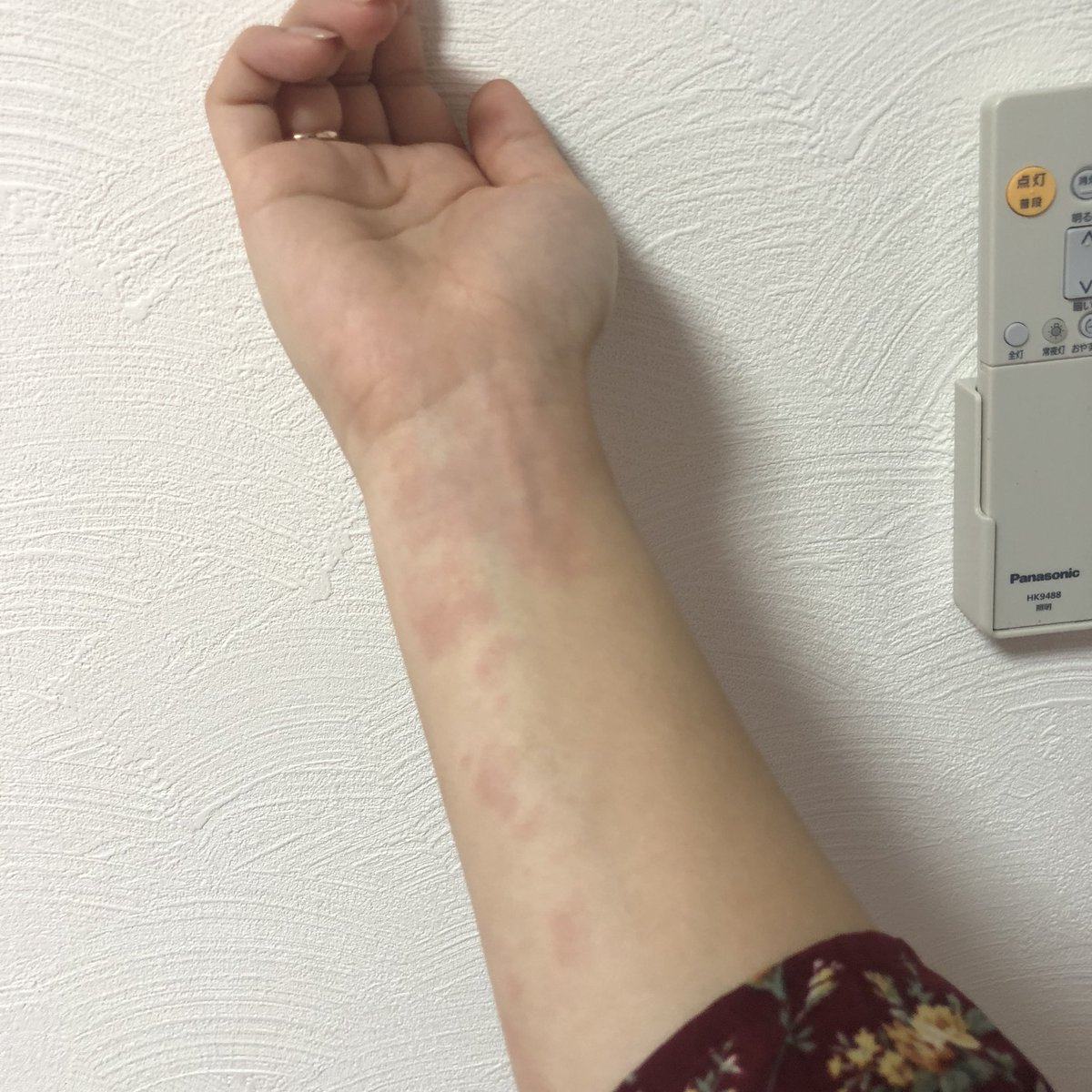 一般 バリー 溶けた 柔軟 剤 かゆい Adanacukurovatemizlik Com