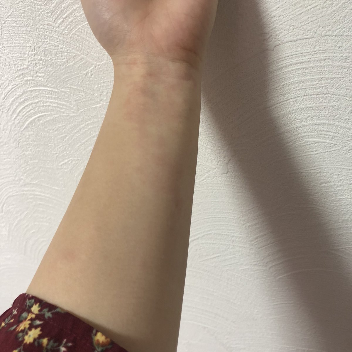 加速する バレエ 環境 柔軟 剤 かゆい Eigolesson Jp