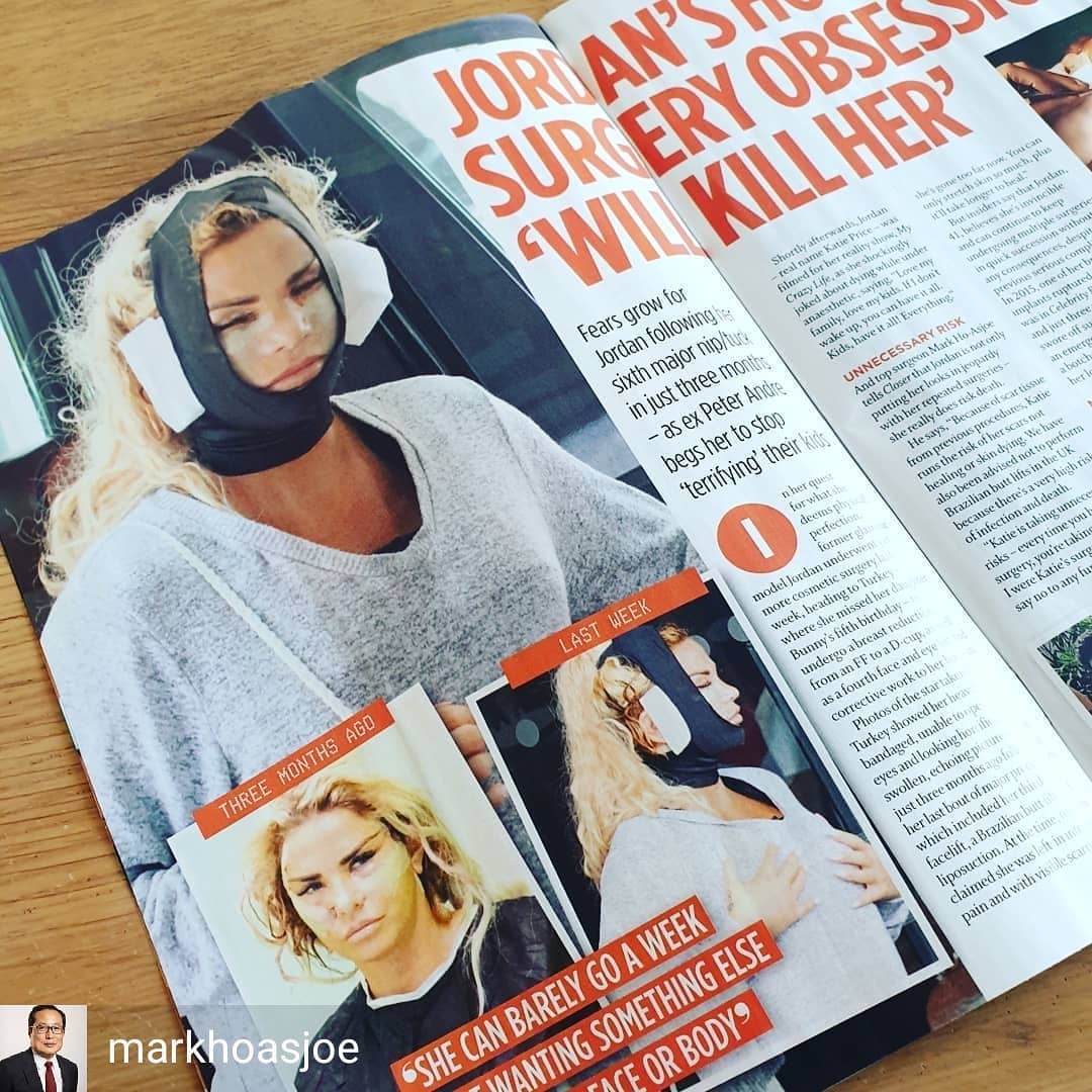 markhoasjoe's tweet photo. My latest comments for @CloserOnline. Always leave yourself time to heal from any type of surgery. #healingproccess #katieprice #closeronline #CosmeticSurgery https://t.co/YsCx5hl1ei