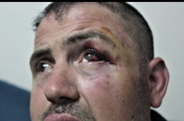 O bir Gazi

Suçu rahatsız olduğu için kafe’de ayaklarını sandalyeye uzatmak

Gazimize bunu yapanların elleri kırılsın İNŞALLAH.

#YaşımızHep18