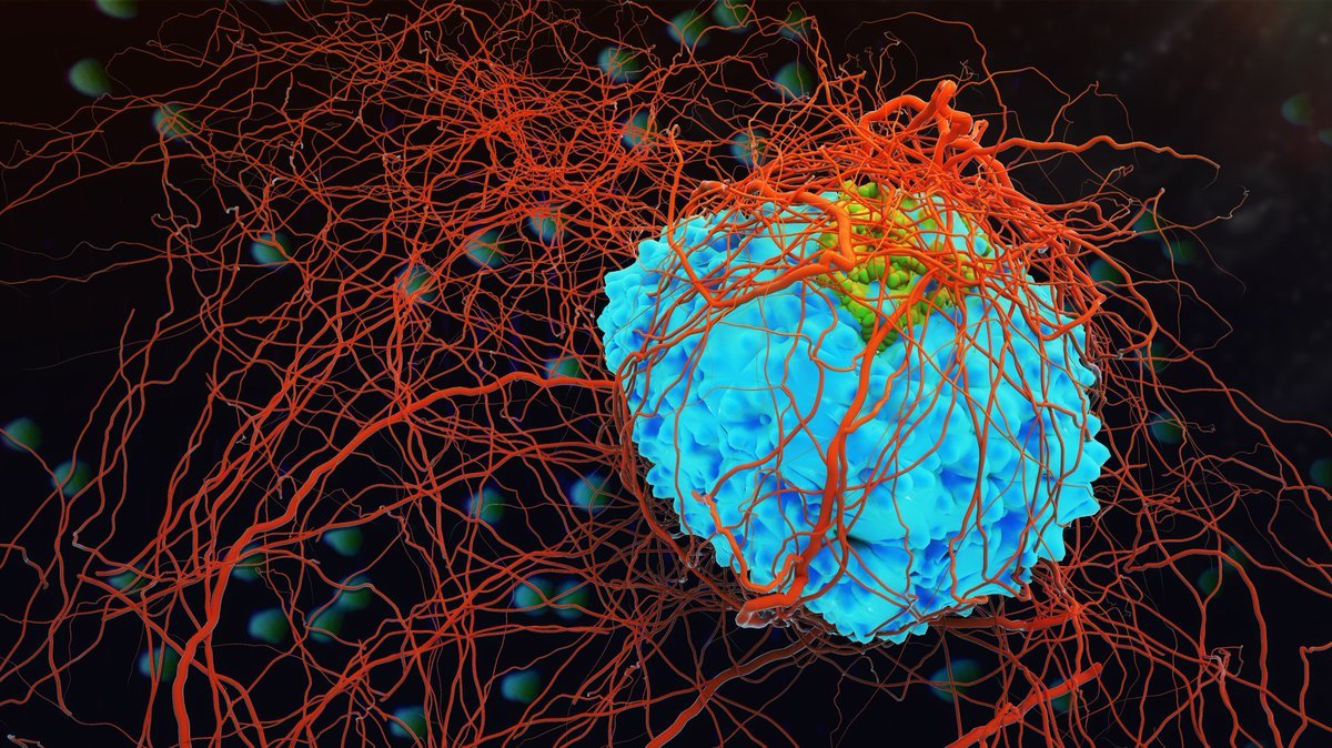 oncologists's tweet photo. Visit: https://t.co/7bp3BHOSAP
According to new studies, Researchers have developed an important new tool towards producing therapies for cancer patients using the patient's own cells.
#TumorImmunology #CancerDiagnostics #CancerNanotechnology #CancerTherapy #GynaecologicOncology https://t.co/tFLpDHGZEN