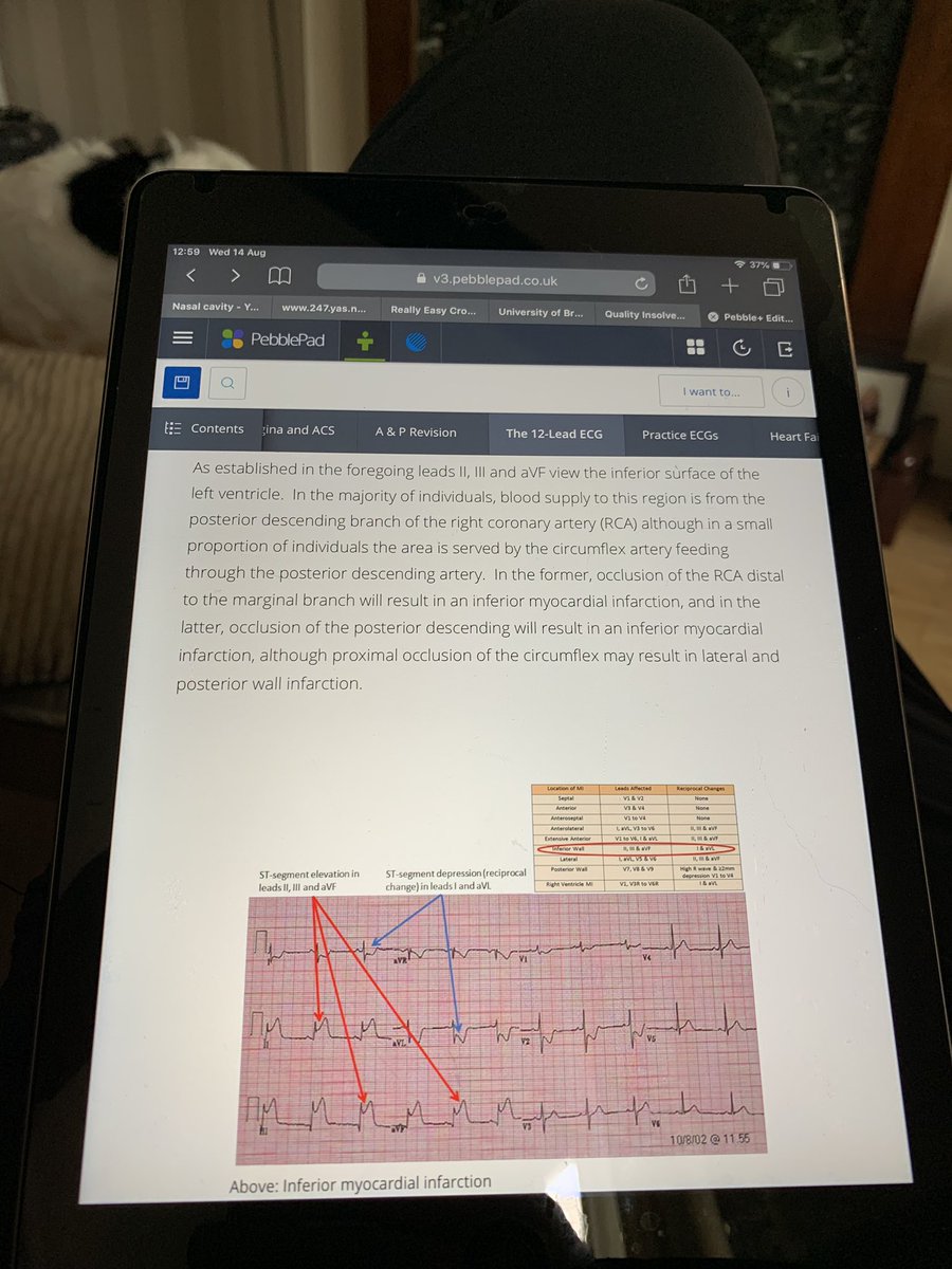 scampster50's tweet photo. Year 2 approaching fast. Best make a start on the pre reading. #studentpara @UniofBradford #study #ECG https://t.co/S9MP6AIaE9