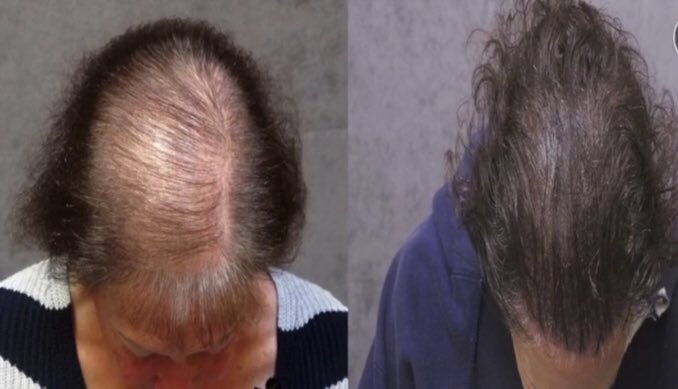 SHERIDAN'S Hair & Scalp studio on Twitter: SHERIDAN'S Hair & Scalp studio on Twitter: