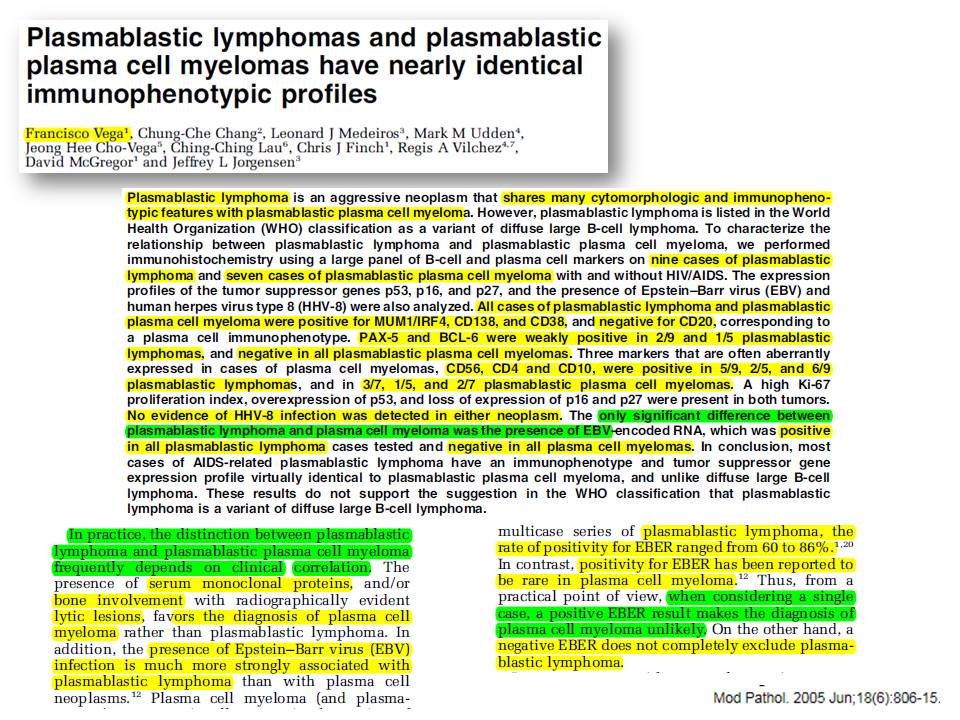 angelpanizo1's tweet photo. @SibaElHussein The distinction between plasmablastic neoplasms is often difficult, particularly in EBV-negative cases arising in immunocompetent adults. 3 papers that can be helpful in this differential
#hemepath 
https://t.co/UZHBMcRc9W
https://t.co/OeRbPrYVOI
https://t.co/jrwnoEysDt https://t.co/ANa70Pue0I