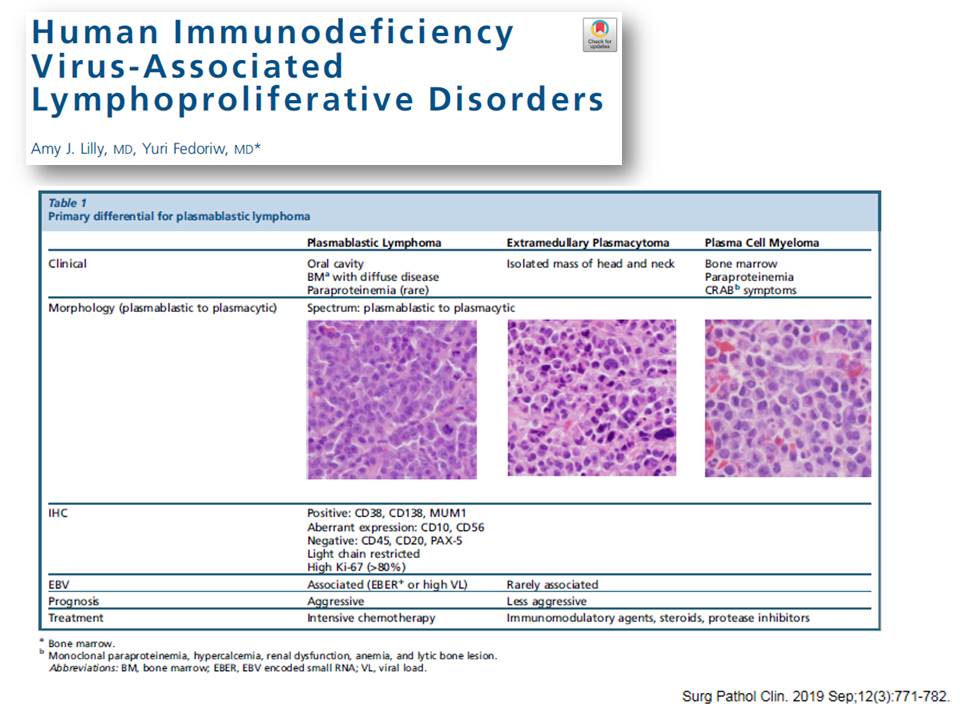 angelpanizo1's tweet photo. @SibaElHussein The distinction between plasmablastic neoplasms is often difficult, particularly in EBV-negative cases arising in immunocompetent adults. 3 papers that can be helpful in this differential
#hemepath 
https://t.co/UZHBMcRc9W
https://t.co/OeRbPrYVOI
https://t.co/jrwnoEysDt https://t.co/ANa70Pue0I