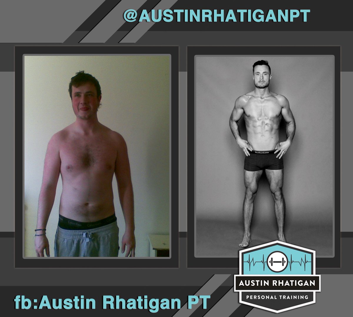 DrEddyClinic's tweet photo. RT @AustinRhatigan: 🍻 🍺 COLLEGE DAYS vs NOWADAYS 🥩🥑
.
.
.
#KETO #LCHF #FunctionalMedicine #ThrowbackTransformation #Dublin #EatRichLiveLong
@FatEmperor @MikeMutzel https://t.co/Ebf3Qtumij