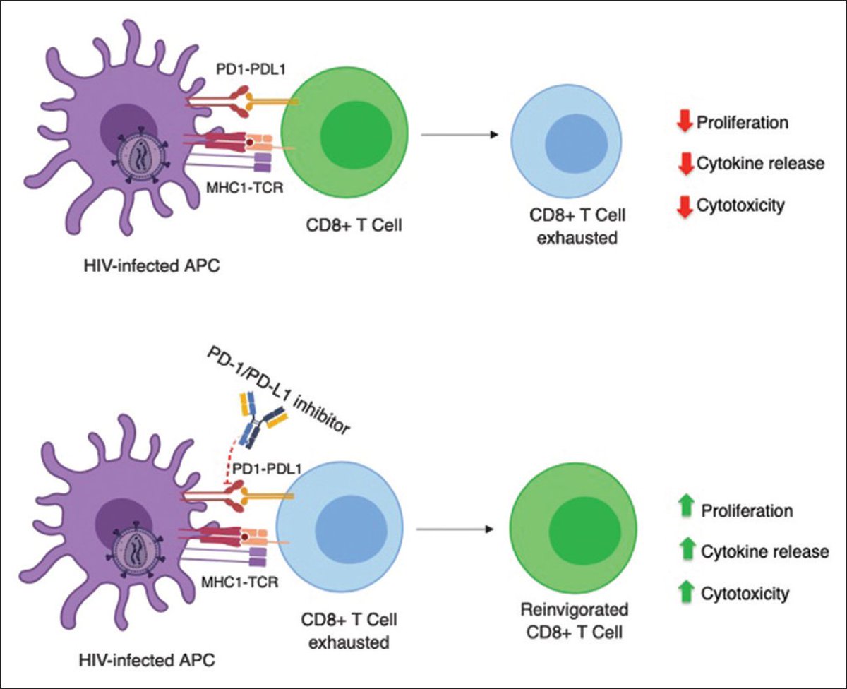 JIPO Editors (@jipoeditors) on Twitter photo Expert Opinion by <a href="/KatherineScilla/">Katie Scilla</a>, <a href="/ChristianRolfo/">Christian Rolfo</a> et al: "Immunotherapy use in patients with HIV and non-small-cell lung cancer: Current data." ow.ly/RtGv50vxGul
#JIPO #oncology #immunotherapy Expert Opinion by <a href="/KatherineScilla/">Katie Scilla</a>, <a href="/ChristianRolfo/">Christian Rolfo</a> et al: "Immunotherapy use in patients with HIV and non-small-cell lung cancer: Current data." ow.ly/RtGv50vxGul
#JIPO #oncology #immunotherapy