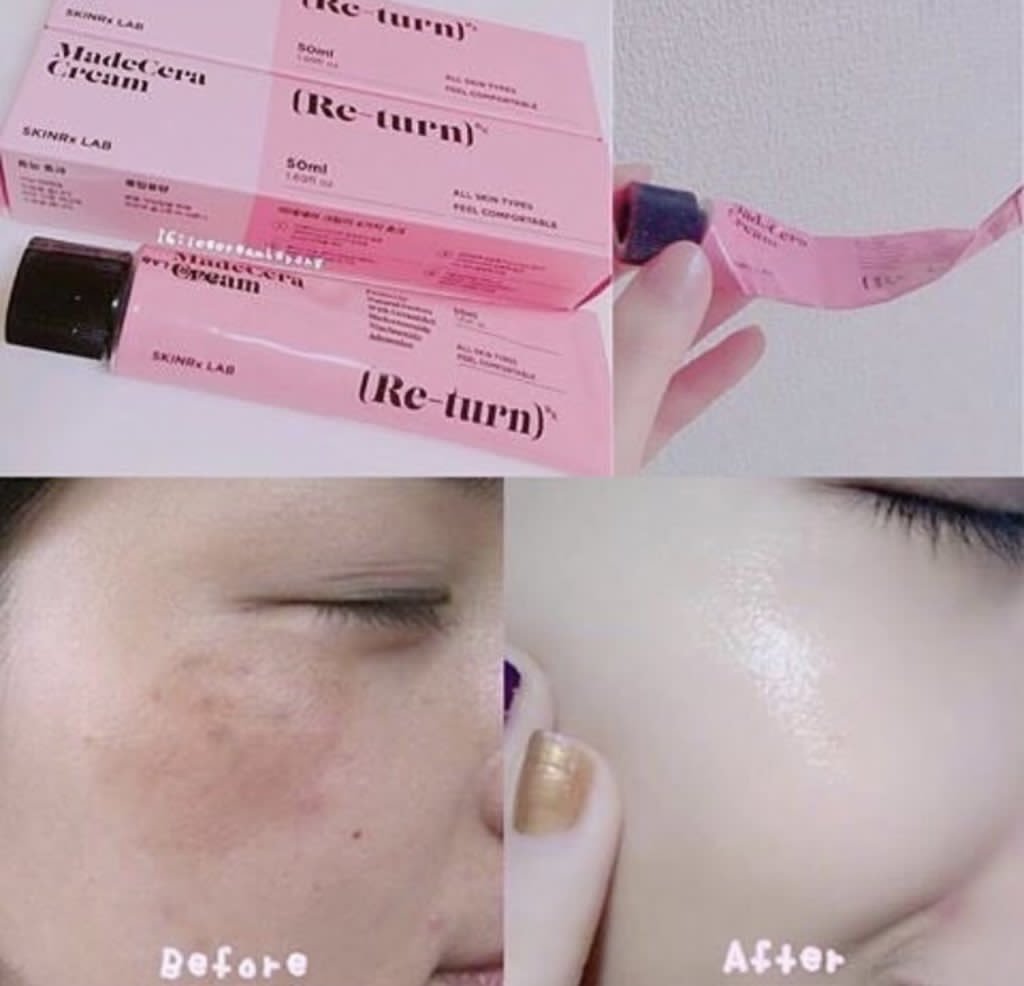 ♦️Soon Jung วิตามินเกาหลี พร้อมส่ง tweet media