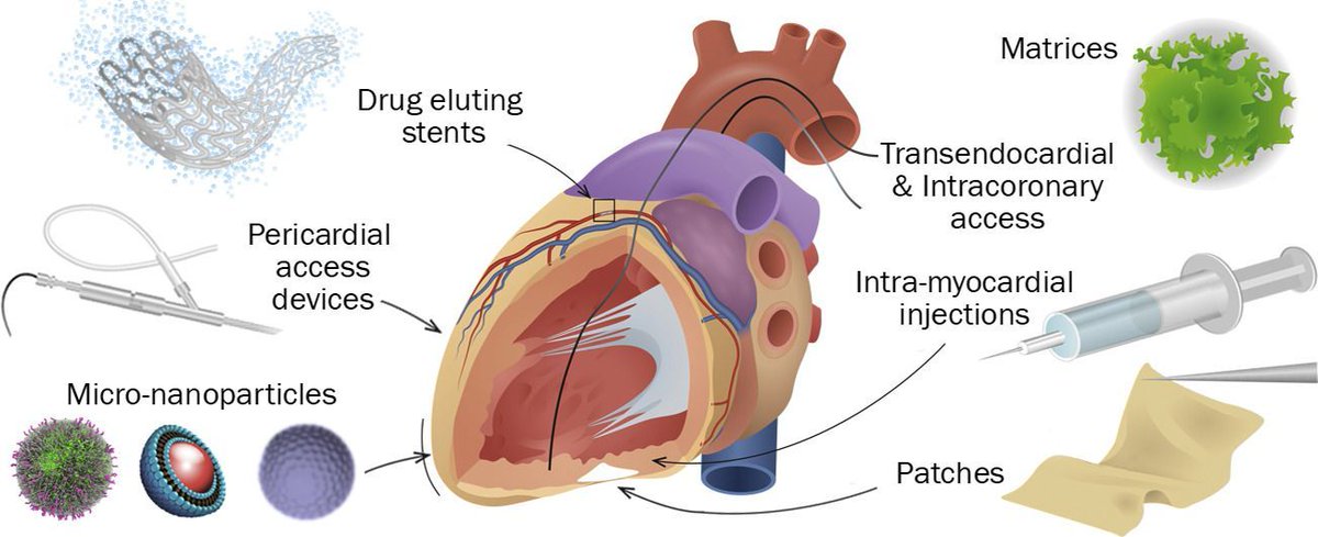 ADDReditors's tweet photo. “Technologies for intrapericardial delivery of therapeutics and cells” presented by Alessandro Grattoni, Carly Filgueira, and Advanced Drug Delivery Reviews. #ADDRjournal #drugdelivery #editorscollection #heart #pericardium Download free until August 19th. https://t.co/9kua50mTad https://t.co/N6Vqbb3TKP