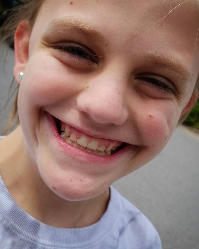 FotosComingSoon's tweet photo. Thank you @roederorthodontics for our #DivaPrincess's beautiful smile!! #Phase2Done #BeautifulSmile #BestOrthodontistEva #DrRo #Braces https://t.co/taf8DBZC73