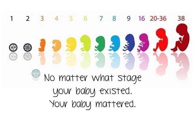 maternalminds_'s tweet photo. #Repost @harrys.butterfly2015
・・・
Your Baby existed.
Your Baby matters. 💜🦋 #harrysbutterfly #ectopicpregnancy #pregnancyloss #miscarriage #babyloss #infantloss #griefquotes #ept1000 ********************************** If you would like to join a dedicated Facebook support… https://t.co/FdW13z3qHk