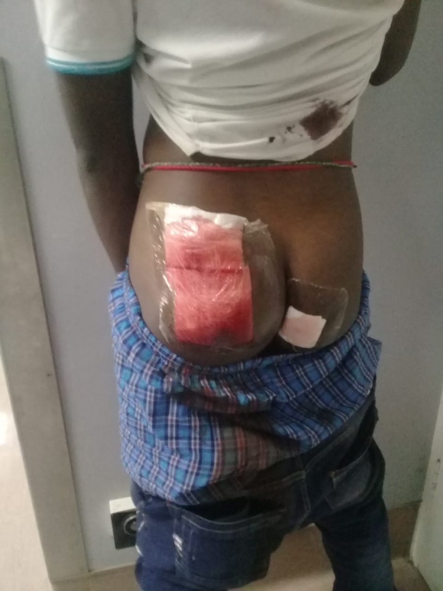 EFFYouthCommand's tweet photo. We are angered to learn seven students have been injured with live ammunition by Tyeks private security in Mthatha. Three remain in hospital critically wounded. One student is fighting for his life in theatre with 7 bullet holes. Zimbane TVET college Nsfas protest @EFFSouthAfrica https://t.co/OwivOG3Gqk