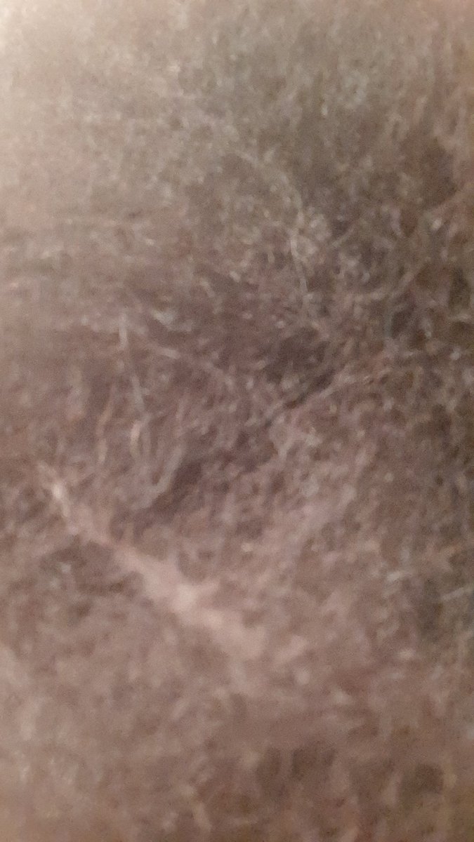 DetroitPrinces4's tweet image. #Greasing my scalp putting in #bantu #knots for the curlzzzz