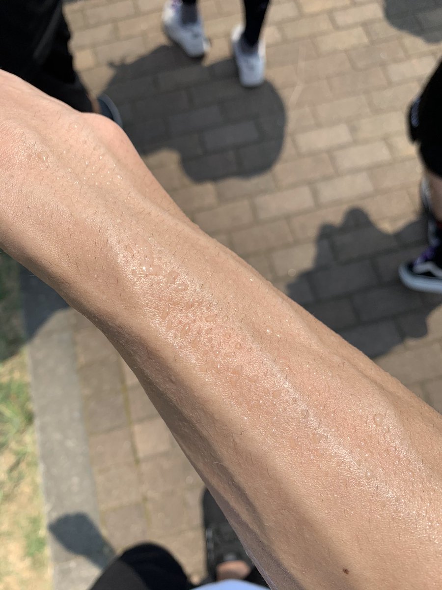 あめ Auf Twitter 開幕bishはダメだわ毛穴どうなってんだ