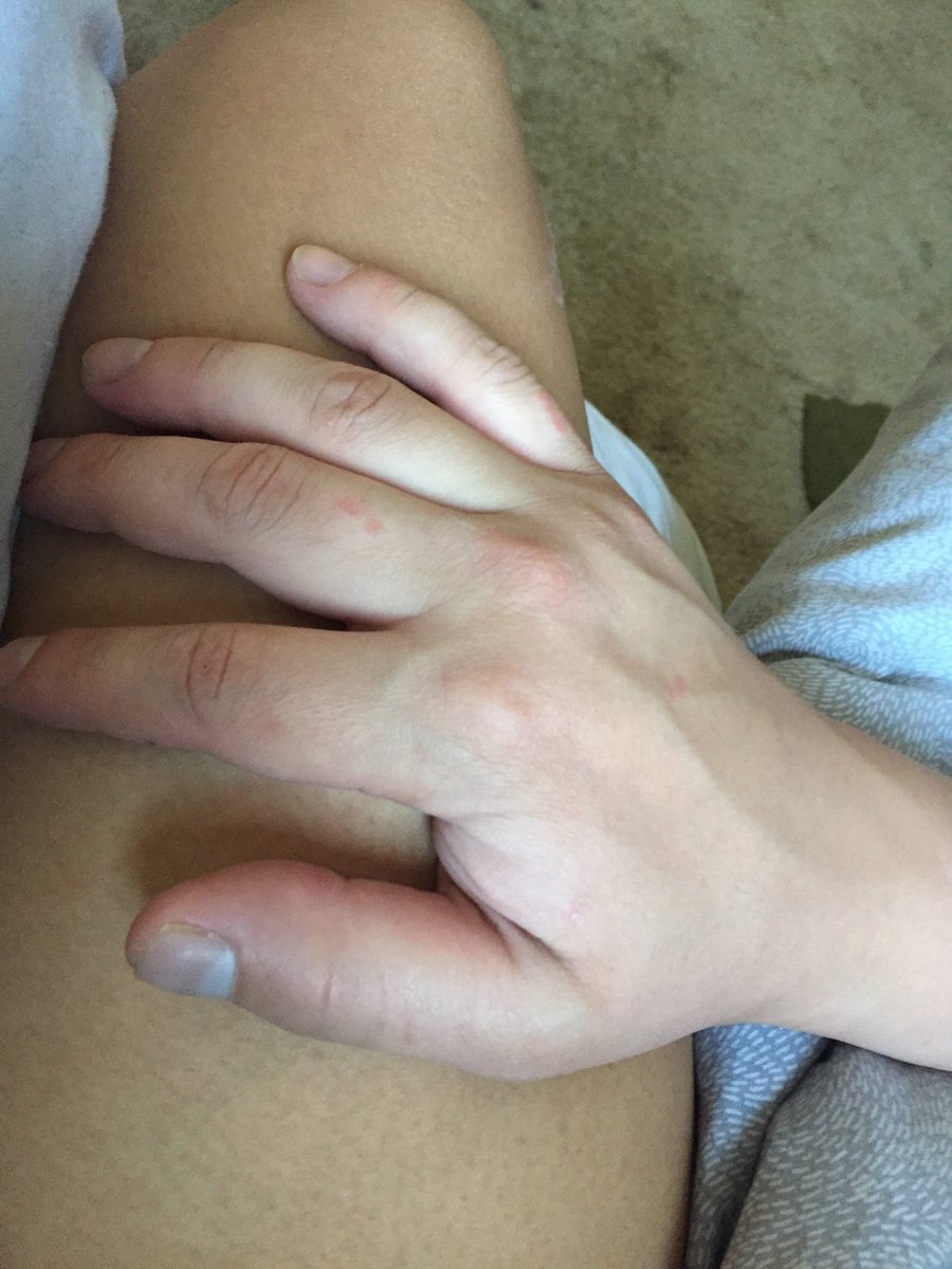 _bombergirl's tweet photo. My babies big hand is big as my leg😝 white- brown https://t.co/FChn8b8A96