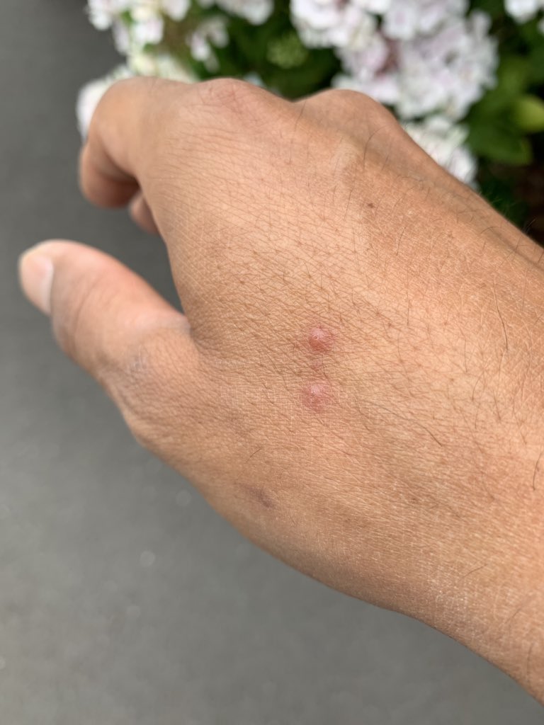 gurmster's tweet photo. I was bitten by a spider this week and have secretly checked if walls have become a bit sticky 😳 @TomHolland1996 #SpiderManDay https://t.co/p9BFEB1Esw