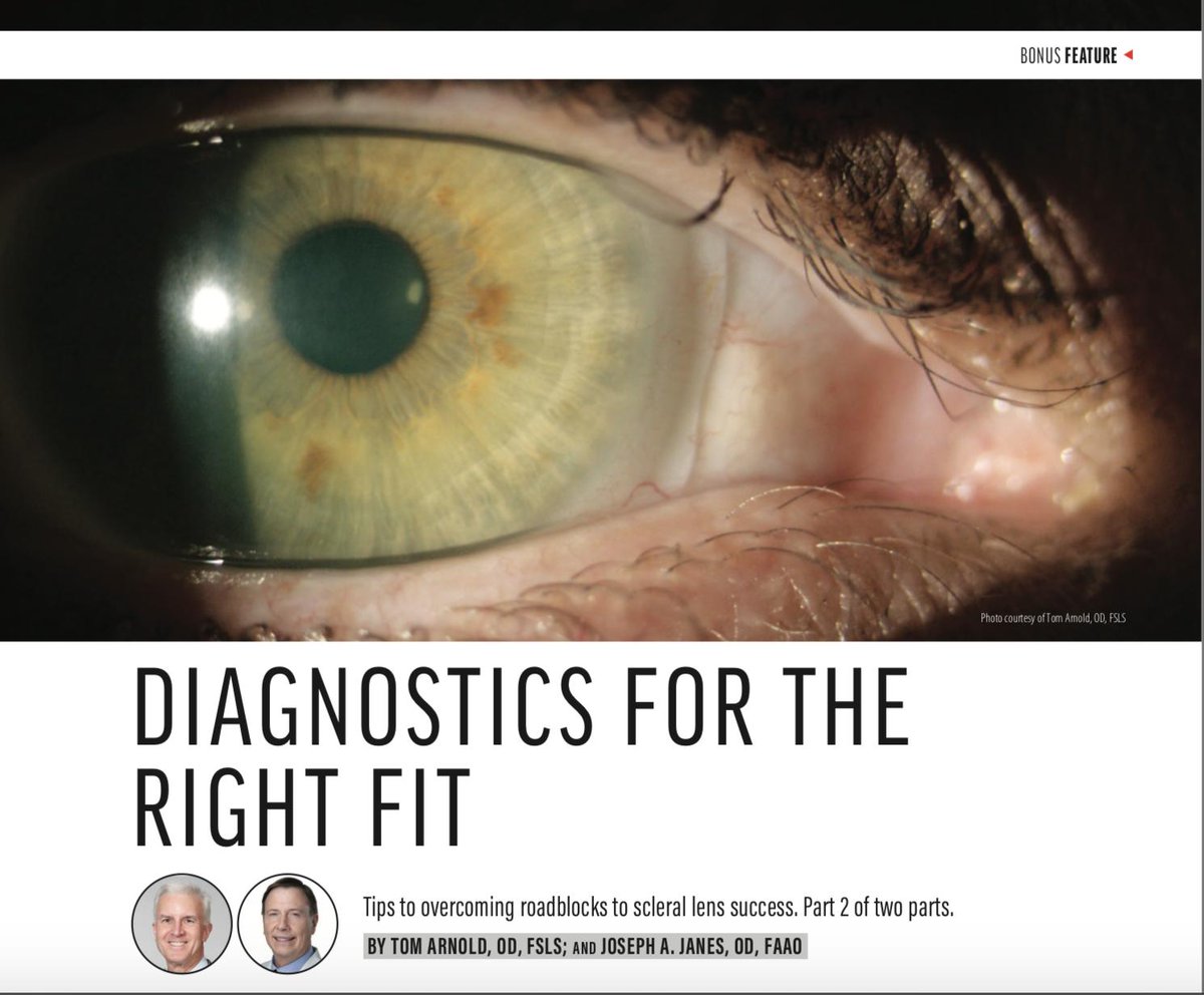 Part 2 of two parts is here! Read Drs. Joseph A. Janes and Thomas P. Arnold's tips to overcoming roadblocks to scleral lens success from the May/June issue of MOD. Read it here: hubs.ly/H0k4SCN0