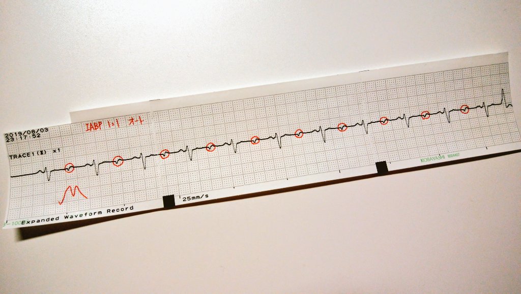 モニター心電図