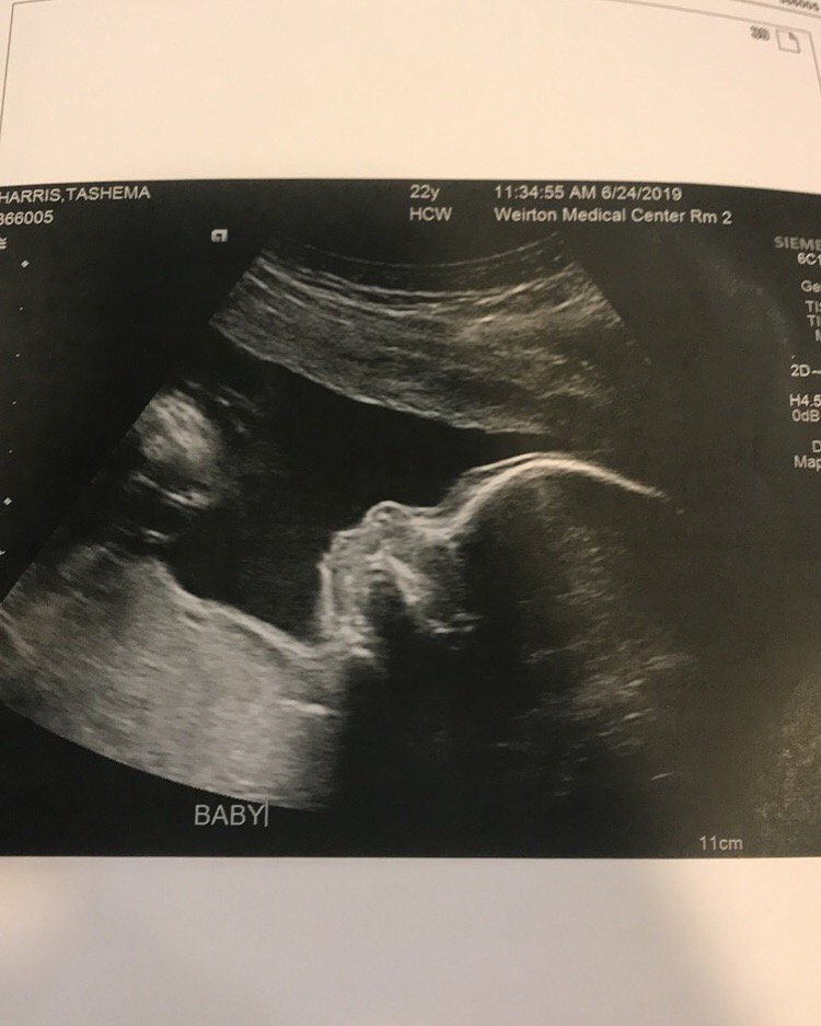 xobeamm's tweet photo. Aunyae Michelle💕🥰 https://t.co/tjSCmeZvFO
