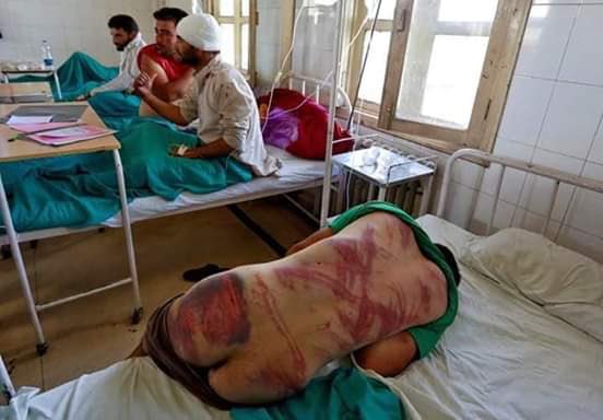 GhaniQuder's tweet photo. Someone raise a voice now that my Kashmir is burning. No justice. Now that my Kashmir is burning. Now remove the cruelty that my Kashmir is burning https://t.co/aOFtO2D4MH