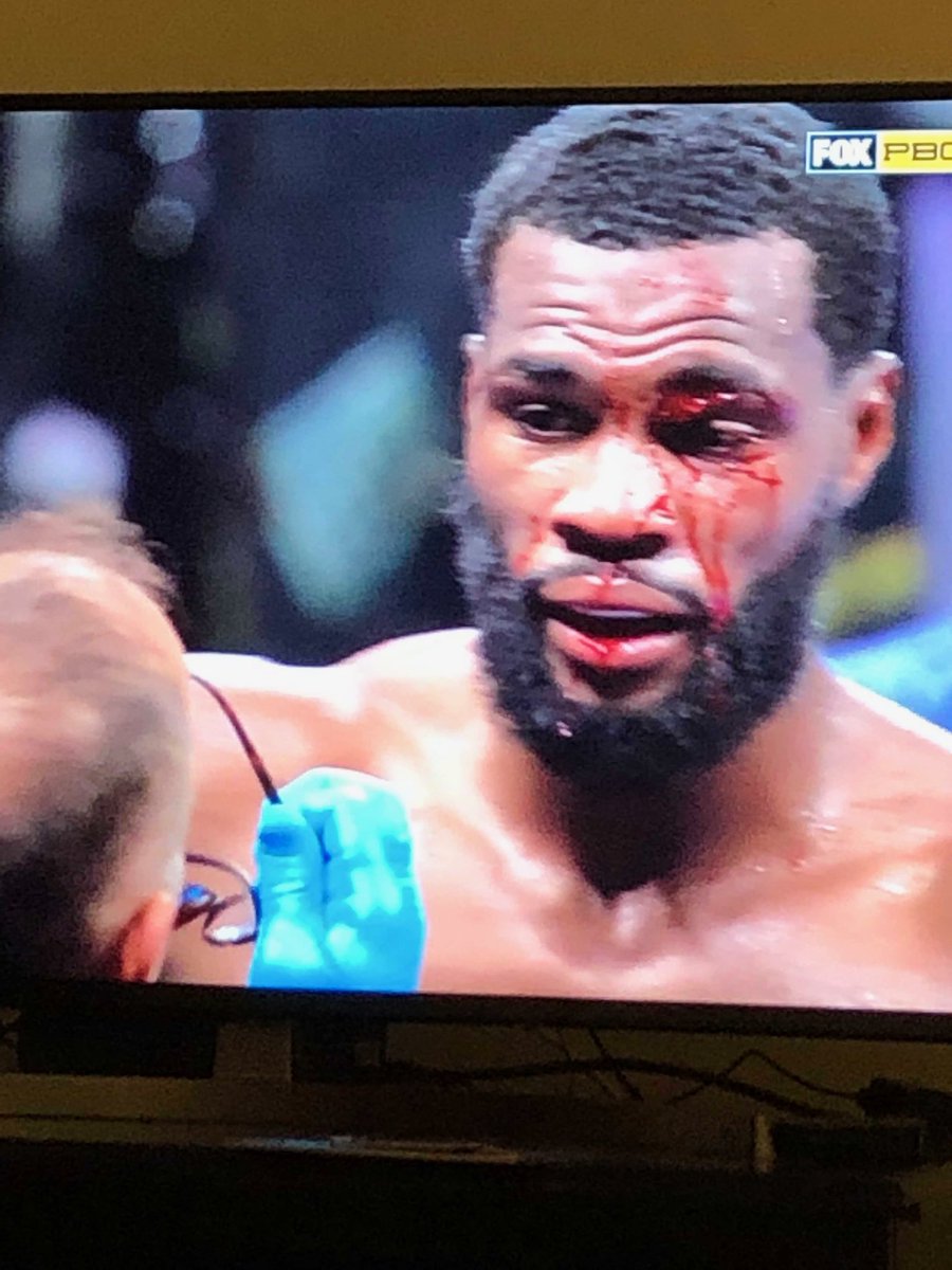 KenMortician's tweet photo. Reminder @BadouJack fought 12 rounds against Browne with a worse cut #BrownePascal https://t.co/K7MfgKYBCP