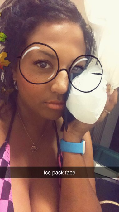 I got headbutted in the face last night. I&rsquo;m avoiding mirrors because I&rsquo;ll be upset if I have a black<a href="/tag/bluemonday"class="tags"><span>#bluemonday</span></a>