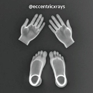 eccentricxrays's tweet photo. His little hands stole my heart and his little feet ran away with it! 🦶✋
#hands #feet https://t.co/ypHFRCPeI4
