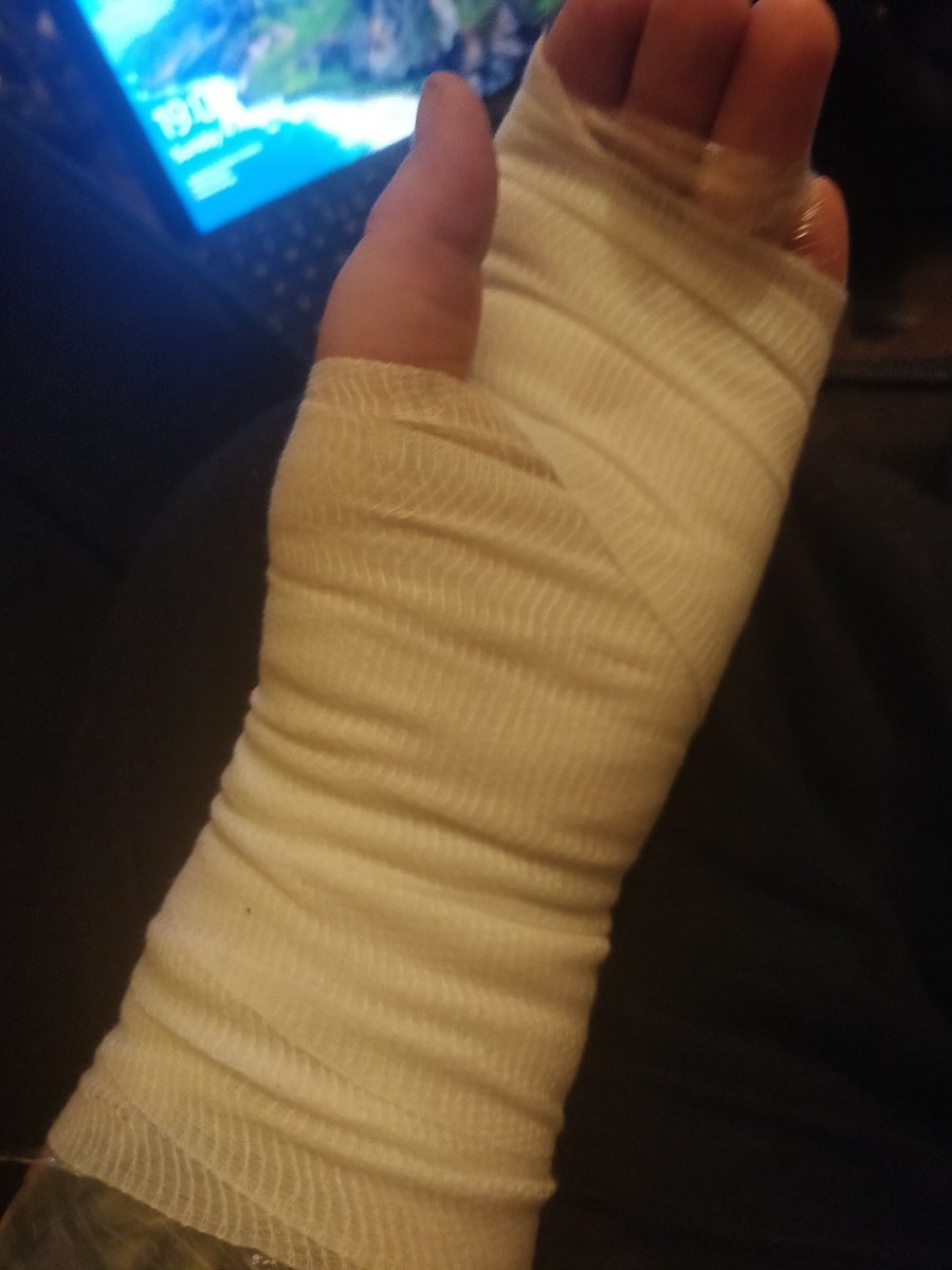 BananaVortex's tweet photo. Well guys... Unfortunately doesn't look like I'm gaming for a few days... At least... Managed to burn my handπππ will deffo try and join @Archiegiemo stream at least for the chats. #twitch #bandage #archiegiemo #burnthand https://t.co/QXkTkEQmKQ