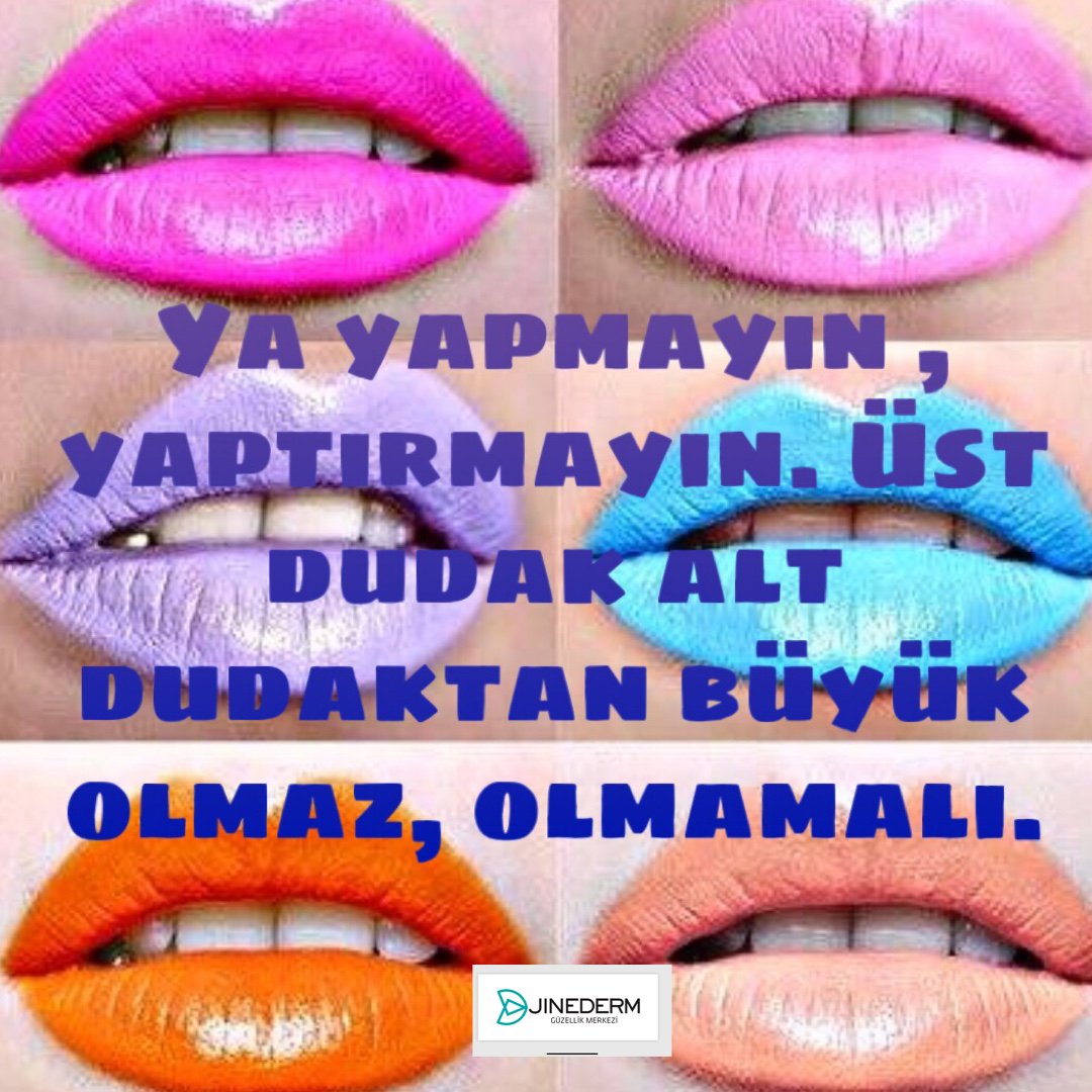 #dudakdolgusu #lipfiller #juvederm #kiss #istanbulestetik