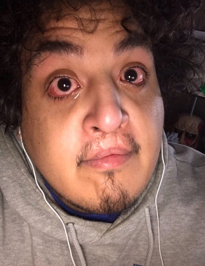 BB (@bbslmonbelt) on Twitter photo 