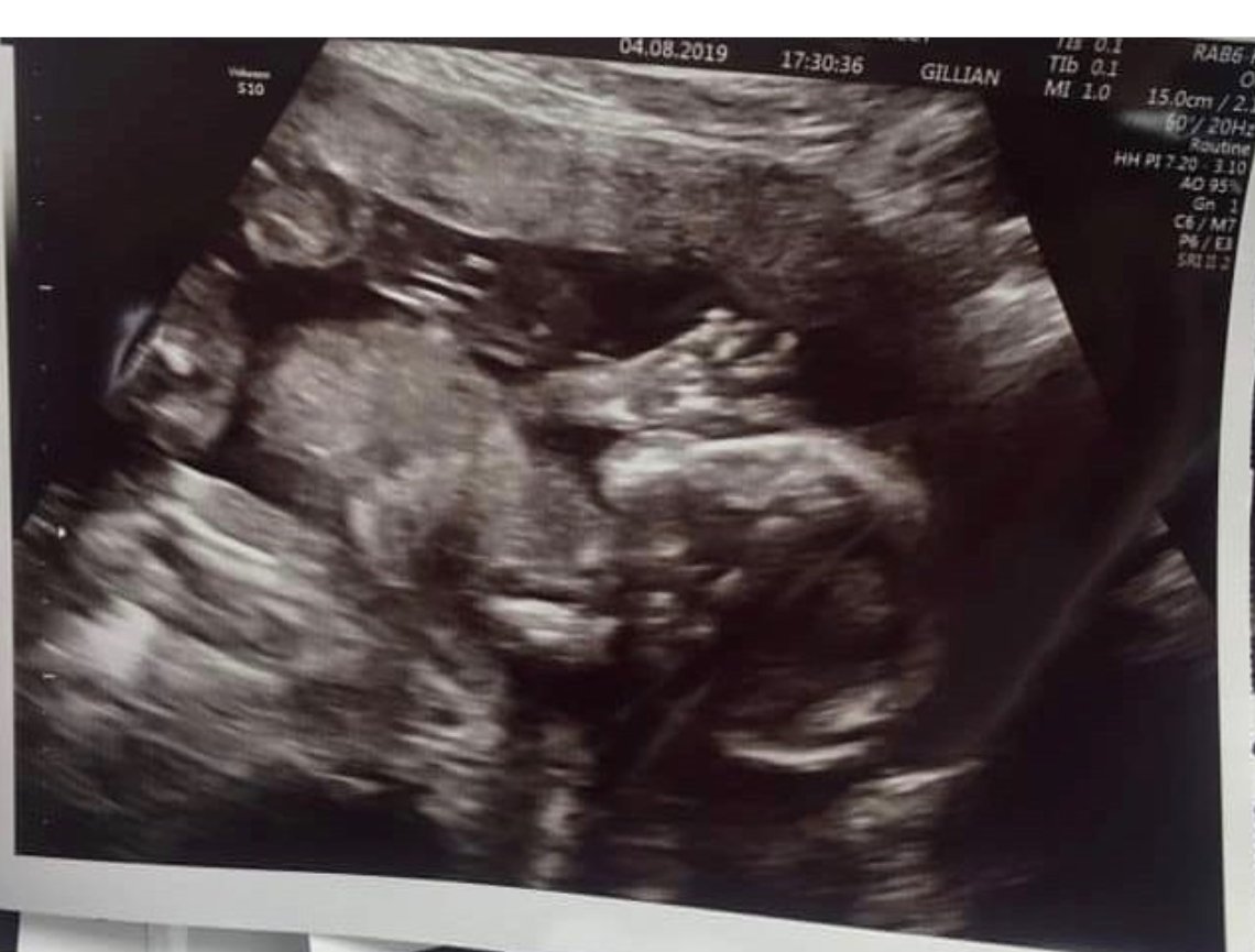 KerriHarding5's tweet photo. Im going to have a grandson, roll on January💙 https://t.co/I0LKrGzuSN