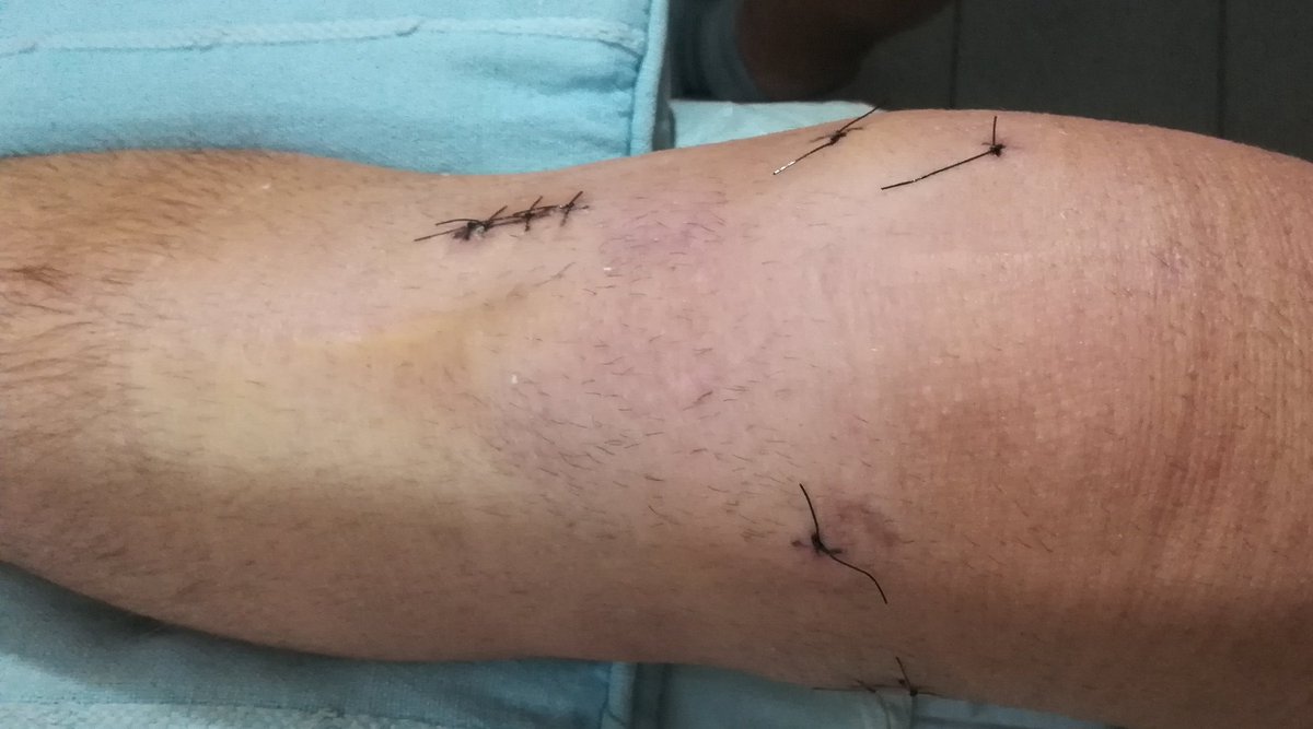 GasparPona's tweet photo. RT para no romperte los ligamentos y los meniscos, ni tener ninguna lesión grave. 🍀 https://t.co/Eles4sRbVz
