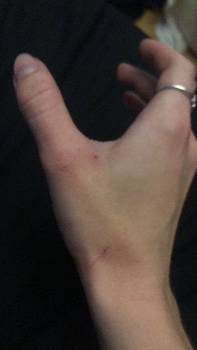 aneisachassity's tweet photo. Said kitten attacked me https://t.co/8Y6riNEK9Z
