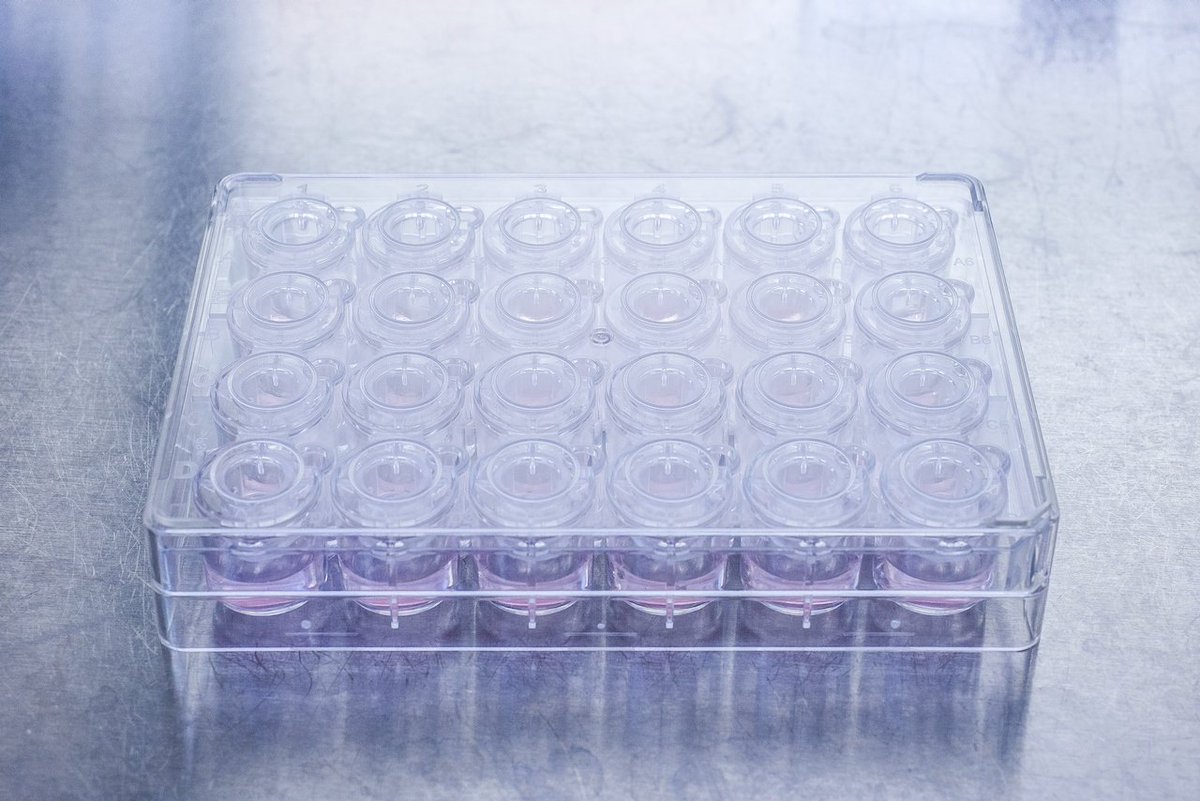 Um den richtigen Geruchsrezeptor für eine spezifische Anwendung zu ermitteln, müssen mehrere tausend Rezeptoren und deren Kombination gescreent werden. Das ist wirtschaftlich nur automatisiert möglich.