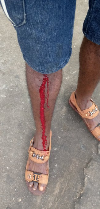 SaharaReporters's tweet photo. FLASH PHOTO: @PoliceNG fires shot at #RevolutionNow protester in Lagos 

#FreeSoworeNow https://t.co/lKNcHVeLBJ